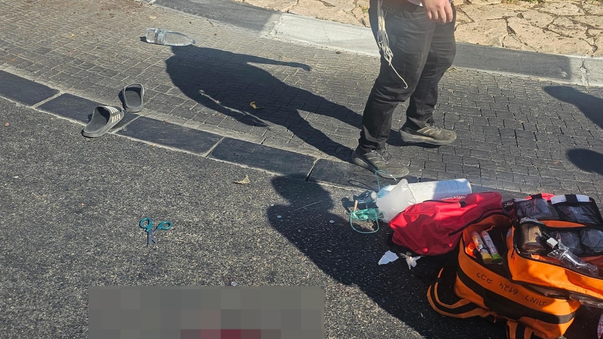 תאונת קורקינט בירושלים: בחור ישיבה נפצע בראשו וברגליו